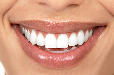 Port Jefferson Smiles-Karen Halpern DMD, MS-crown lengthening